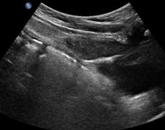 ultrasound anatomy coloring book cystic endometrial tumor uterus pinterest coloring anatomy book ultrasound 