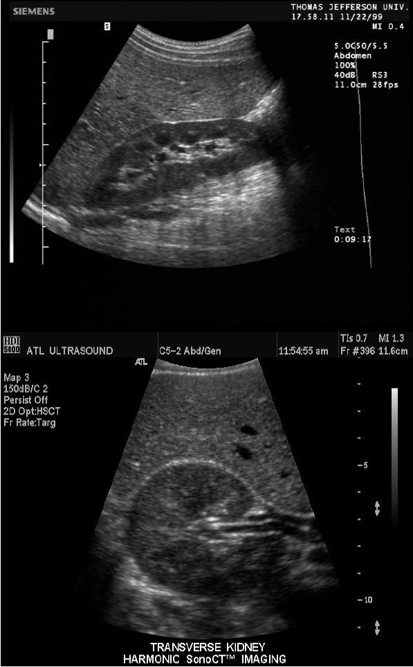 ultrasound anatomy coloring book quadratus lumborum muscle on ultrasound google search ultrasound coloring book anatomy 